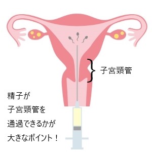 artificial-insemination
